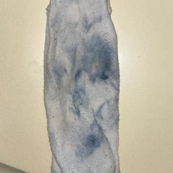 6000 TL'lik New Balance Ayakkabısının Erken Renk Açması Ve Tiftiklenmesi İade Talebi