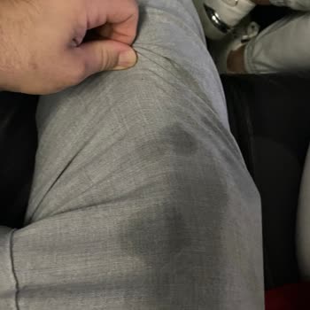 Uçuşta Kahverengi Su Sızıntısı Kıyafetlerime 2600 TL Zarar Verdi