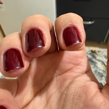 Hijyen Kurallarına Uymayan Güzellik Salonu İşlemi Sonrası Enfeksiyon