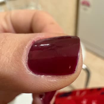 Hijyen Kurallarına Uymayan Güzellik Salonu İşlemi Sonrası Enfeksiyon