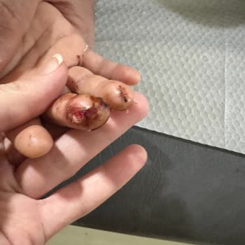 Diyarbakır Yediiklim Kolejinde Hatalı Masa Nedeniyle Çocuğumun Ciddi Kazası Ve Okulun İhmal Tutumu