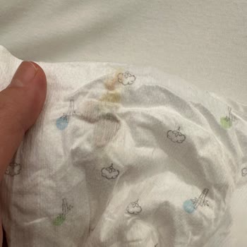 Bebek Bezinde Belirsiz Kalıntı: Güvenlik Ve İhmalkârlık Şikayeti