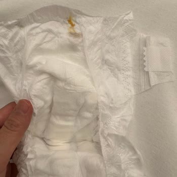 Bebek Bezinde Belirsiz Kalıntı: Güvenlik Ve İhmalkârlık Şikayeti