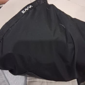 Avva Montunda Dikişten Tüy Dökülmesi Ve Çözüm Sunulmaması