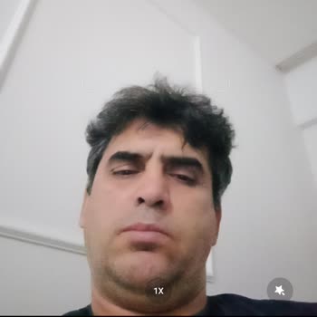 Redmi 10 Kameraları Kendi Kendine Yer Değiştiriyor