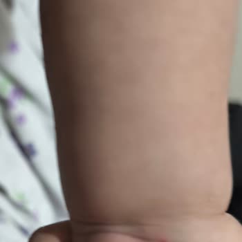 1 Yaşındaki Çocuğumun Anestezi Ve Tomografi Sürecinde İhmal Ve Kötü Muamele