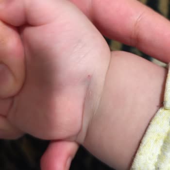 1 Yaşındaki Çocuğumun Anestezi Ve Tomografi Sürecinde İhmal Ve Kötü Muamele