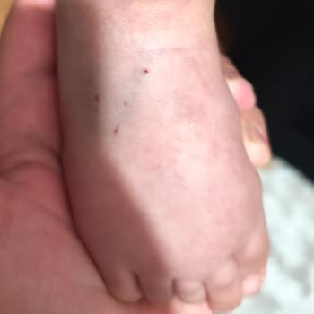 1 Yaşındaki Çocuğumun Anestezi Ve Tomografi Sürecinde İhmal Ve Kötü Muamele