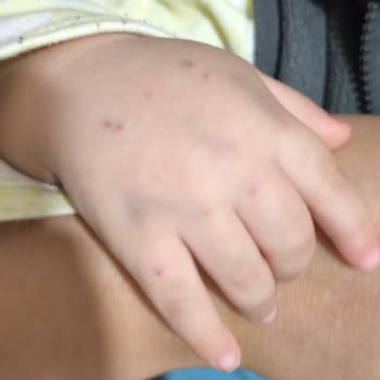 1 Yaşındaki Çocuğumun Anestezi Ve Tomografi Sürecinde İhmal Ve Kötü Muamele