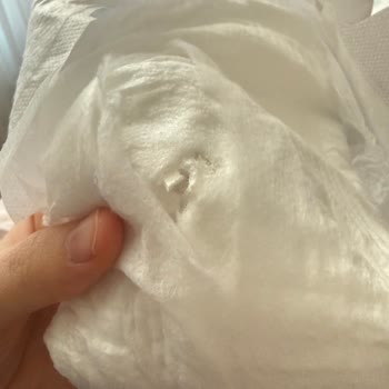 Molfix Bebek Bezinde Sert Beyaz Parçalar Cilt Hasarı Riski