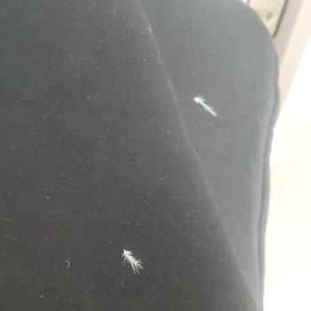 Pierre Cardin Montunda Aşırı Tüylenme Ve İade Reddi