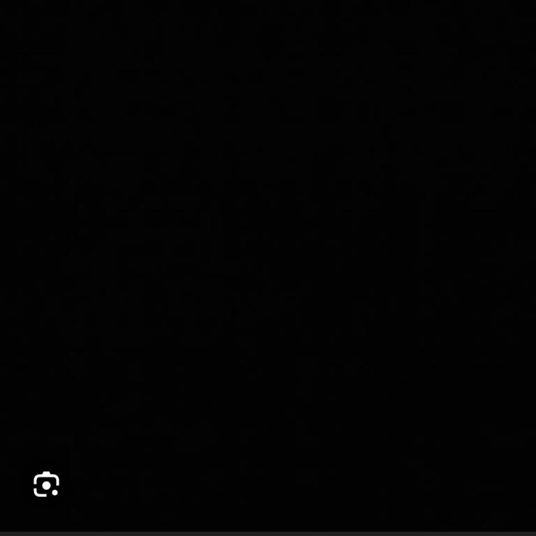 Akdeniz Üniversitesi Hastanesi 3,5 Milim Hata Ve Hatalı Gözlük Sebebiyle Göz Dışa Kaydı