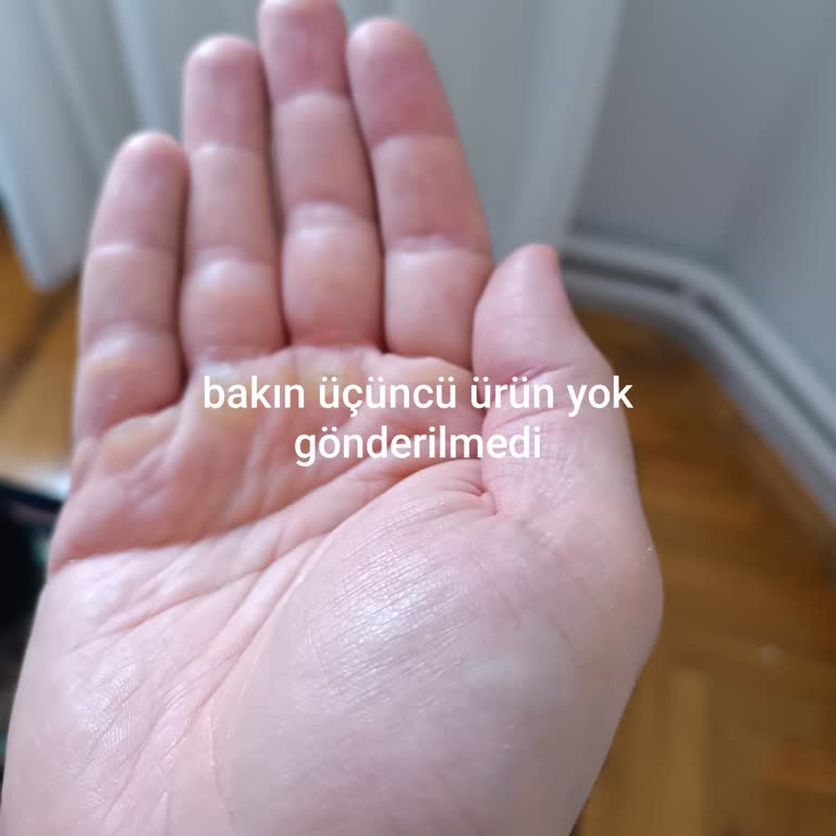 Eksik Çocuk Beresi Gönderilmedi, Ücret İadesi Bekliyor