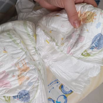 Şok Markette Defolu Molfix Bebek Bezleri: Ücretsiz Değişim Ve Resmi Özür Talebi