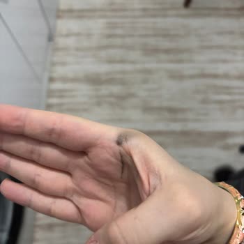 Arzum Mano El Blender Seti Arızası Ve Güvenlik Riski İçin Ücret İadesi Talebi