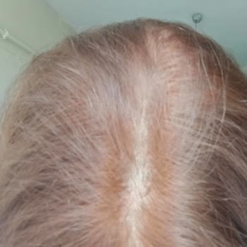 Ambalajdaki Yanıltıcı Renk Skalası: Saç Boyası Kestane Bakır Tonu