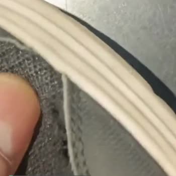 Skechers Ayakkabı 3 Ayda Ne Hale Geldi!