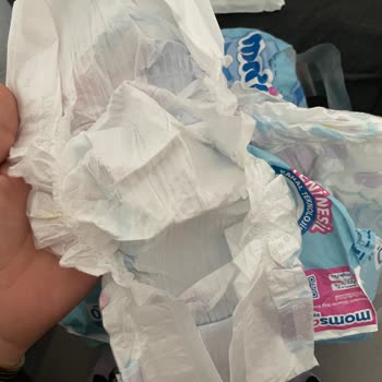 Molfix Bebek Bezi İç Dolgusu Eksik Pakette Güven Endişesi