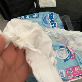 Molfix Bebek Bezi İç Dolgusu Eksik Pakette Güven Endişesi