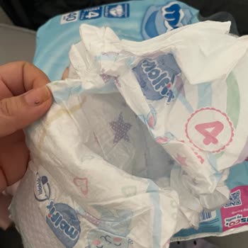 Molfix Bebek Bezi İç Dolgusu Eksik Pakette Güven Endişesi