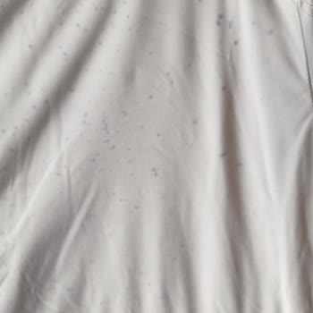 Garanti Kapsamındaki Montta Mavi Leke Sorunu İçin FLO Mağazası Reddi