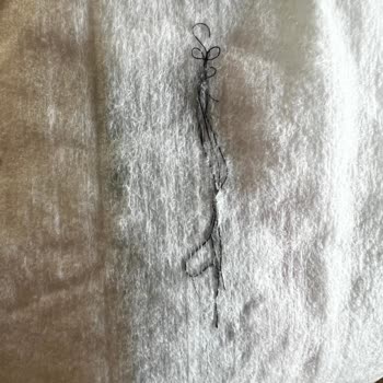 Temizlik Havlusunda Yabancı Madde Tespiti Ve Hijyen Endişesi