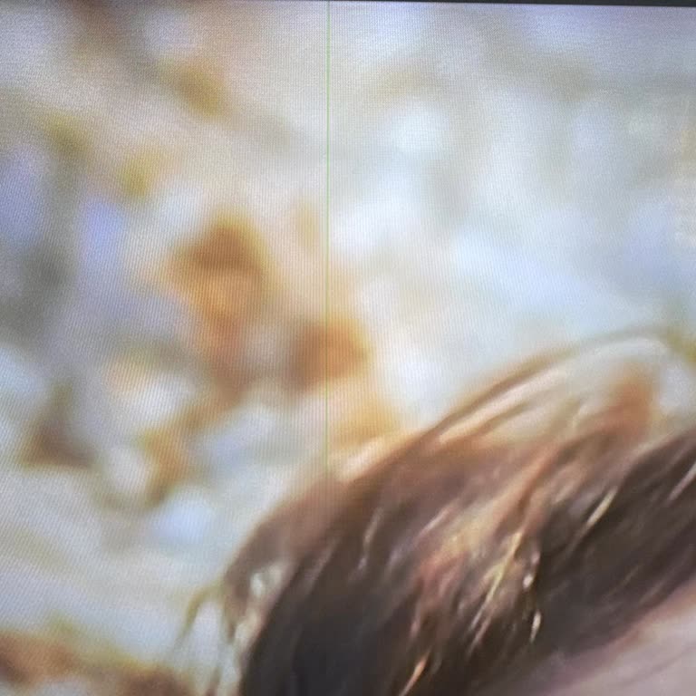 Garanti Sonrası Samsung TV'de Panel Arızası Ve 34 Bin TL Tamir Ücreti