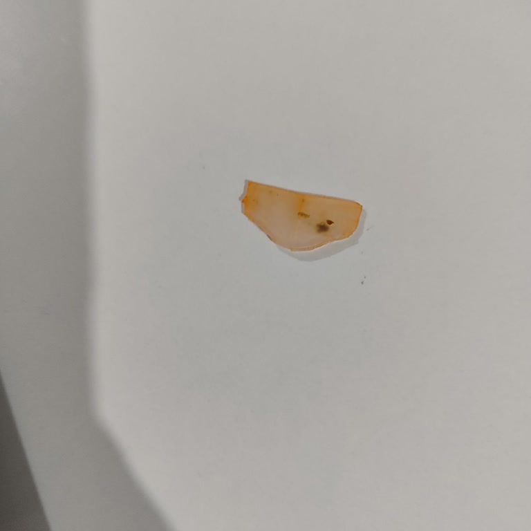 Donmuş Ispanakta Plastik Kontrol Kapağı Bulunması Ve Gıda Güvenliği Açıklaması Talebi