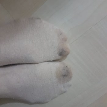 Botta Su Alması Ve Deformasyon, Para İadesi Talebi