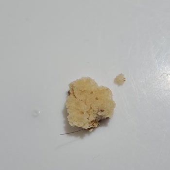 Ülker Halley Bisküvi İçinde Kıl Tespiti Ve Hijyen Şikayeti