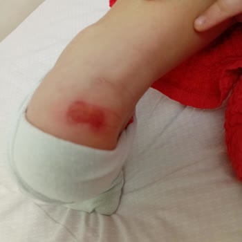 Kinetix Çocuk Botu Ayak Bileğinde Yara Açtı Ücret İadesi Ve Değişim Talebi