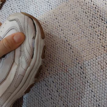 Garanti Süresi İçinde Skechers Ayakkabısının Yan Kırılma Şikayeti