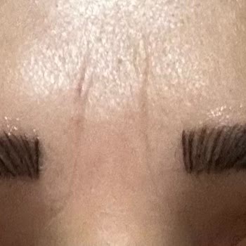 Kıl Tekniği Söylendi, Pudralama Yapıldı Ve Ücret İadesi Talep Ediliyor