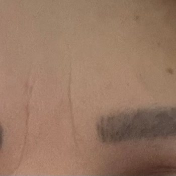 Kıl Tekniği Söylendi, Pudralama Yapıldı Ve Ücret İadesi Talep Ediliyor