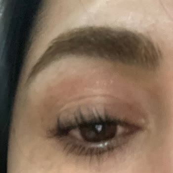 Kirpik Liftinginde Aşırı Kıvırma Ve Eşitsizlik: 1000 TL İadesi Talebi