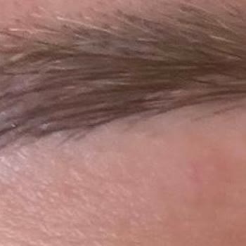 Microblading Yanıltıcı Sözler, Kalıcı İzler Ve Beklentileri Karşılamayan Sonuç