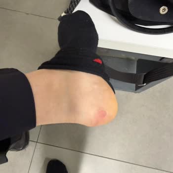 Divarese George Hogg Botunun 3 Kez Giyildikten Sonra Kırılması ve Mağaza Personelinin İlgisiz Tutumu