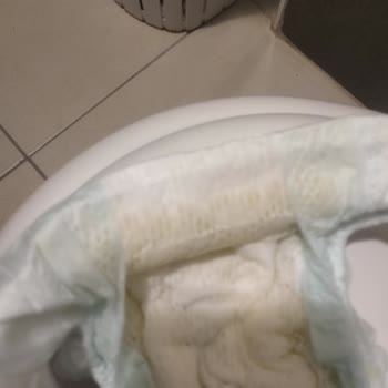 Prima Premium Care Bezleri Sızdırıyor, Üç Kat Fiyatına Karşı Cevap Yok