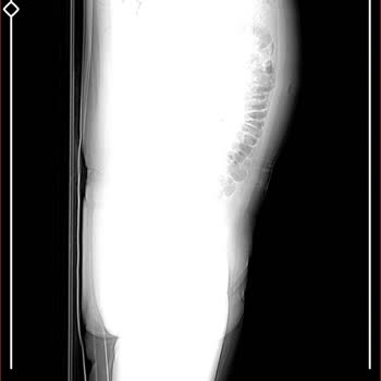 The Elysium İstanbul Yaşadığım Ciddi Yaralanma