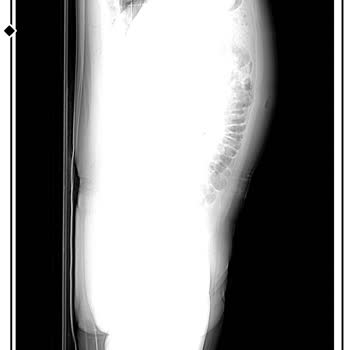 The Elysium İstanbul Yaşadığım Ciddi Yaralanma