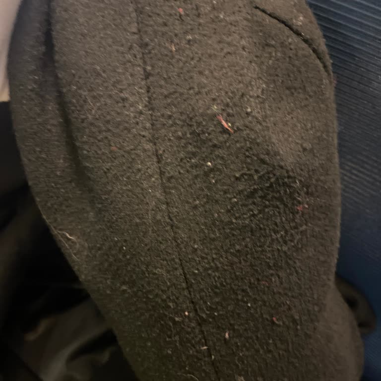 Bershka Kabanı Topaklandı Ve Müşteri Hizmetleri Çözüm Sunmadı