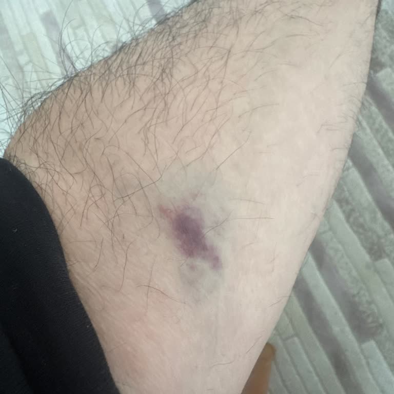 Lokman Hekim Hastaneleri Yanlış Serum Uygulaması Ve Saygısız Hemşire Tutumu!