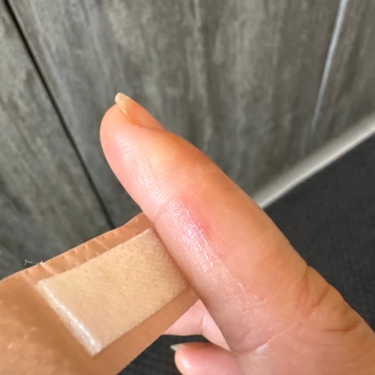 Assu Şişe Kapakları Keskin, Parmakları Kesiyor