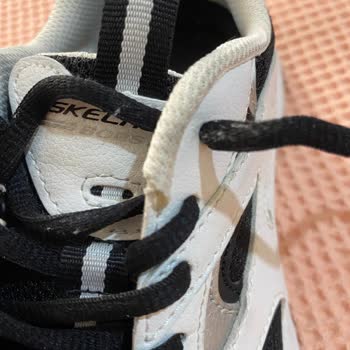 Az Kullanılan Skechers Ayakkabısında Delik Ve Açılma, Red Sonucu Ve İade Talebi