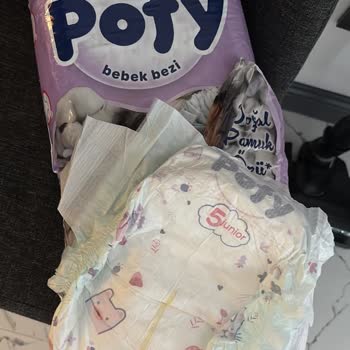 Pofy Bebek Bezinin Şiddetli Yanık Benzeri Cilt Yaraları Oluşturması