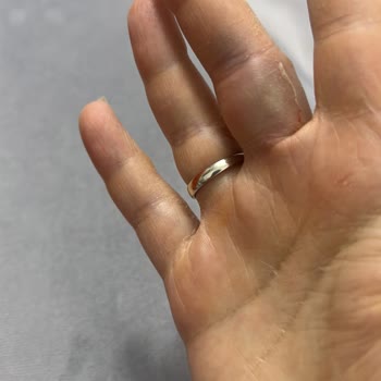 Philips Süpürge Borusu İçeri Kaçıyor Ve Parmağımı Sıkıştırıyor, Değişim Talebi