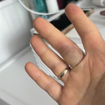 Philips Süpürge Borusu İçeri Kaçıyor Ve Parmağımı Sıkıştırıyor, Değişim Talebi