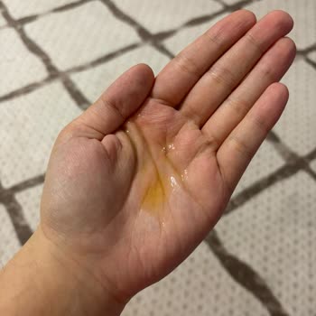 Sephora’dan Gelen C Vitamini Serum Bozulmuş Ve Kullanılamaz