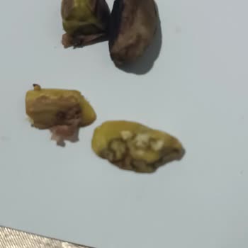 Eti Karam Çikolatasında Çürük Antep Fıstıkları Tüketim Güvenliğini Tehdit Ediyor