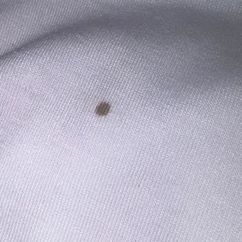 Fotoğraftaki Ürünle Uyuşmayan Kargo, Boya Leke Ve Beden Yanlışlığı